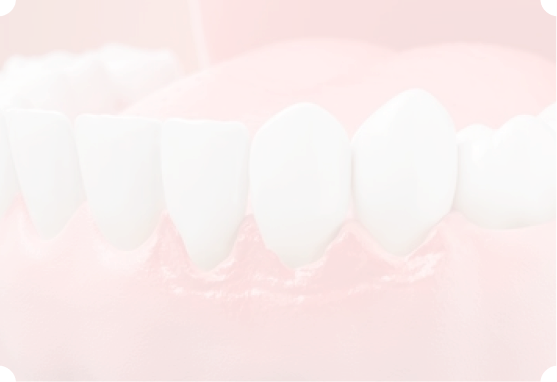 歯周病治療