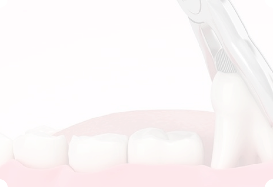 歯科口腔外科(親知らず)