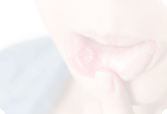 歯科口腔外科(粘膜疾患)